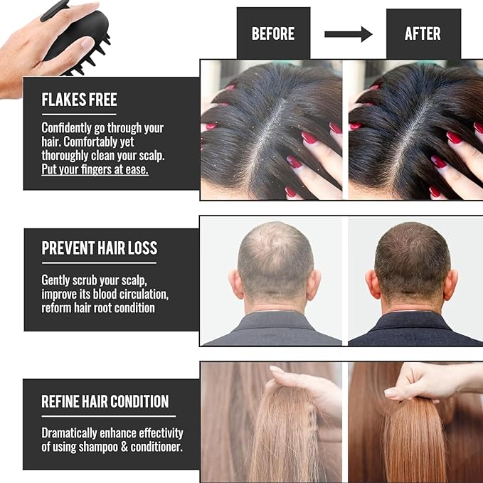 MZEL Silicone Scalp Massager Shampoo Brush for Hair Growth, Beard Brush for Men, Face & Beard Scrubber Exfoliator, Wet Dry Shower Head Scalp Massager for Exfoliating Dandruff, Gifts for Him Father