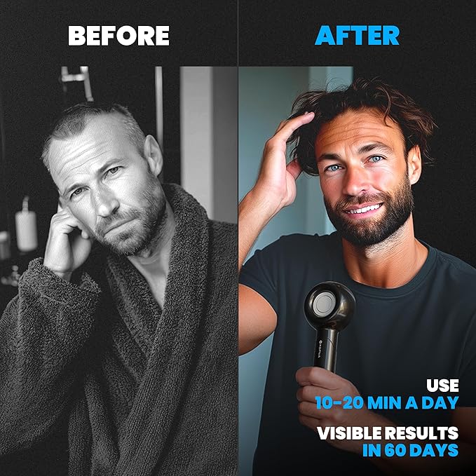 2-in-1 Electric Scalp Massager with Precision Serum Diffuser for Men – Cordless Scalp Care Brush, Supports Fuller-Looking Hair, IPX7 Waterproof, Built-in Nano Mist Diffuser